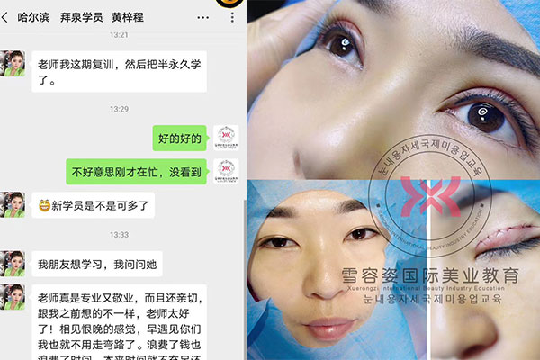 微整形培训机构，双眼皮技术得到了赵老师真传。